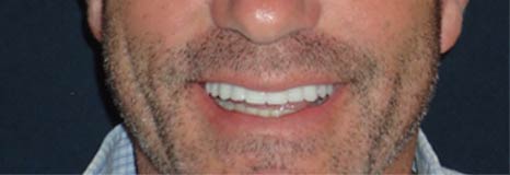 dentist near me after cosmetic dentistry