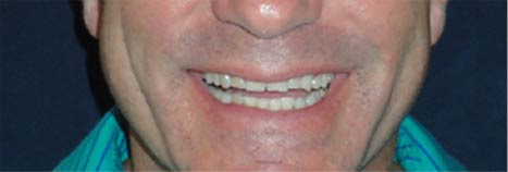 dentist near me cosmetic dentistry before