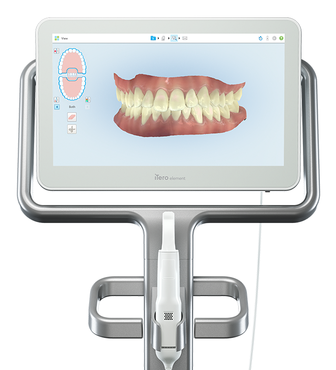 Invisalign Itero