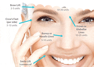 dentist-near-me-huntley-facial-esthetics dentist near me Lindenhurst facial esthetics