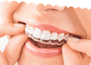 dentist near me Lindenhurst Invisalign